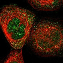 FAM69A Antibody, Novus Biologicals 25 &mu;L, Unlabeled:Antibodies, Polyclonal